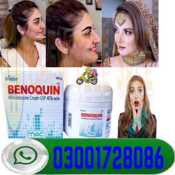 Benoquin Cream Price In Hyderabad # 03001728086 # Order Now