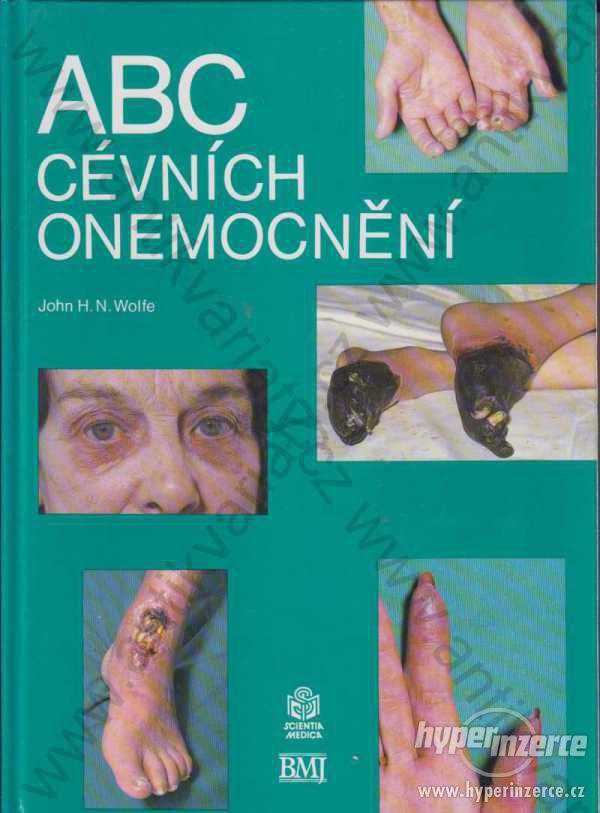 Abc cévních onemocnění John H.N. Wolfe 1994 - foto 1