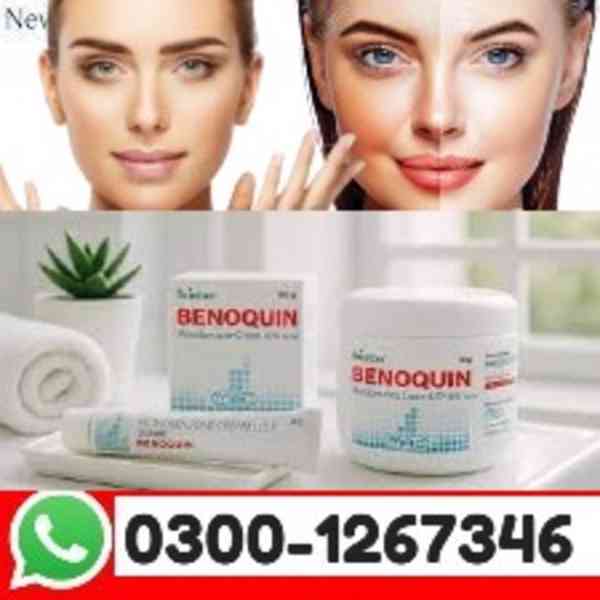 Benoquin Cream Online In Multan | 0300-1267346 | Order