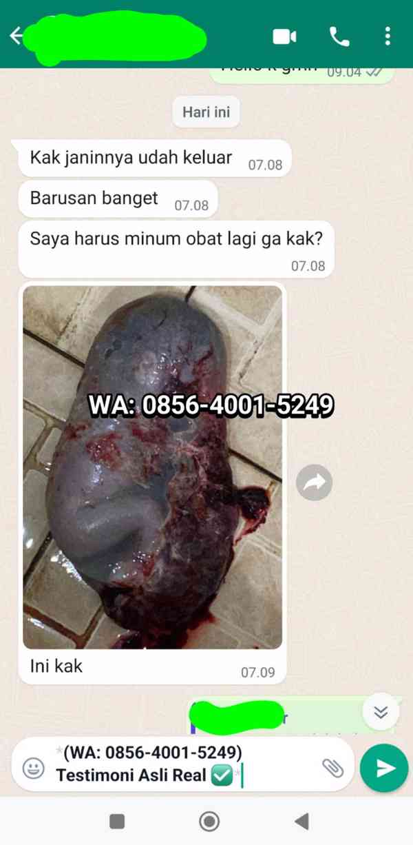 Obat Pelancar Haid 085640015249 Cytotec Jual Di Jakarta