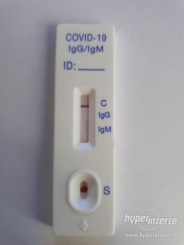 Koronavirus testy - foto 2