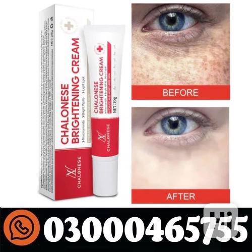 Chalonese Brightening Cream In Pakistan | 0300-0465755 - foto 1