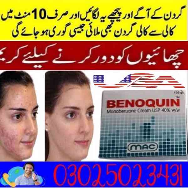 Benoquin Cream In Bahawalpur ~ 03025023431 ~ Online - foto 1