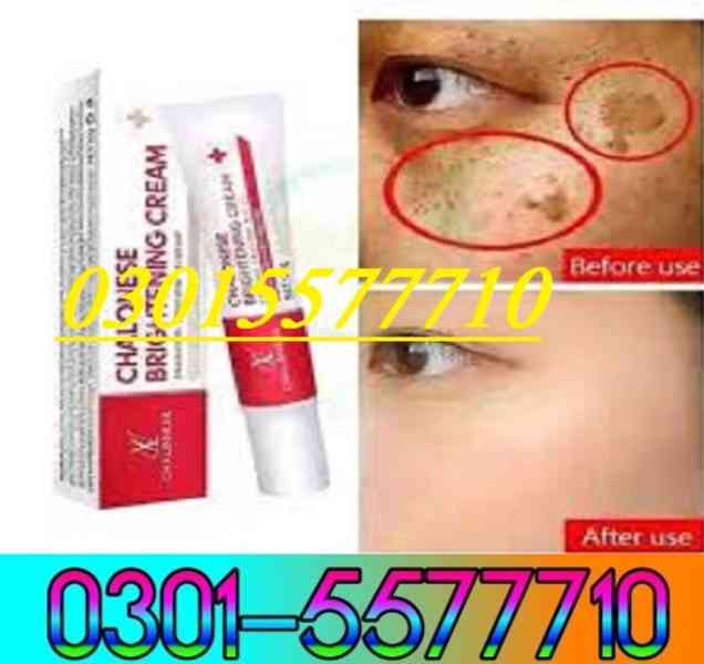 Chalonese Brightening Cream price in Islamabad - 03015577710 - foto 3
