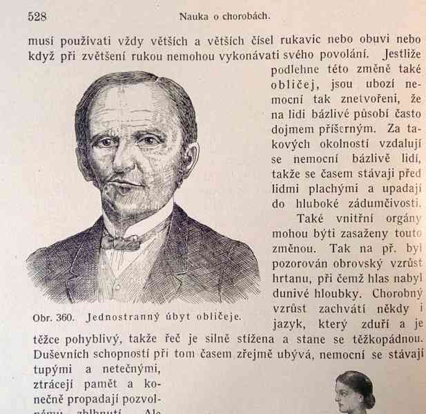 Starožitné lékařské knihy Nové domácí léčení, 1920 - foto 7