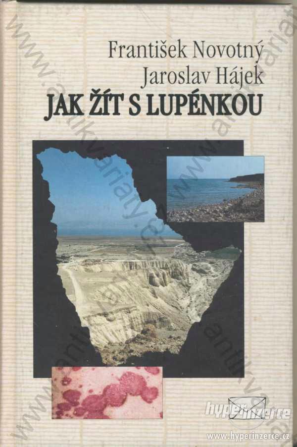 Jak žít s lupénkou, Novotný, Hájek Makropulos,1995 - foto 1