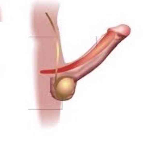 Africká medicína. lék na erekci penisu. lék na život.