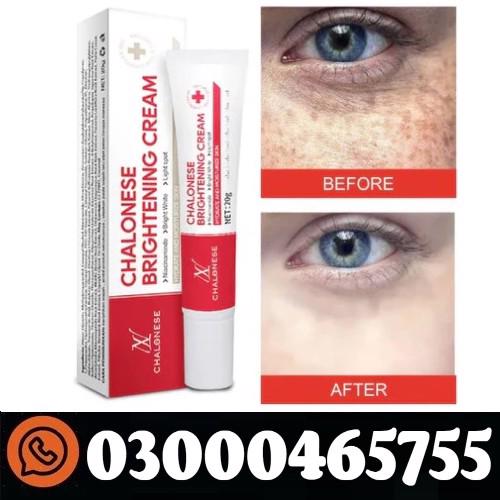 Chalonese Brightening Cream In Pakistan | 0300-0465755