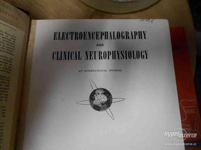 Electroencephalography and Clinical Neurophysiology - foto 1