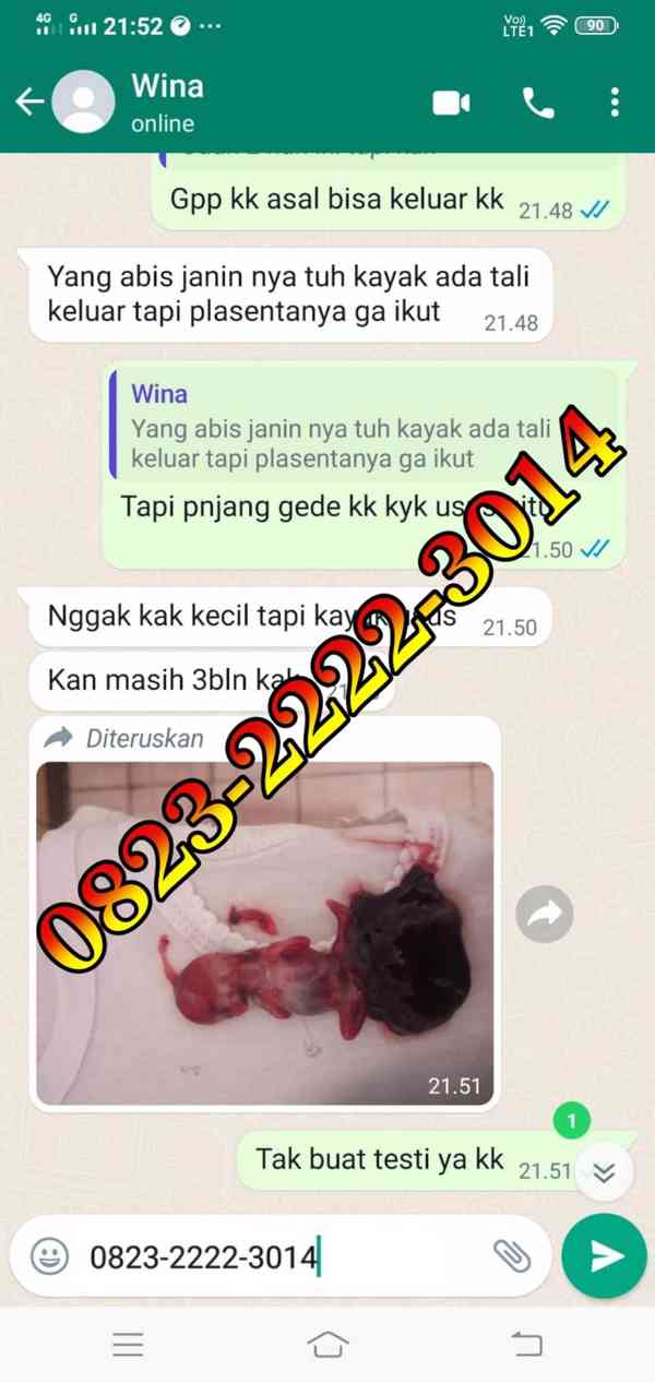 Jual Obat Cytotec Di Shopee Bekasi 082111126033 Obat Cytotec - foto 1