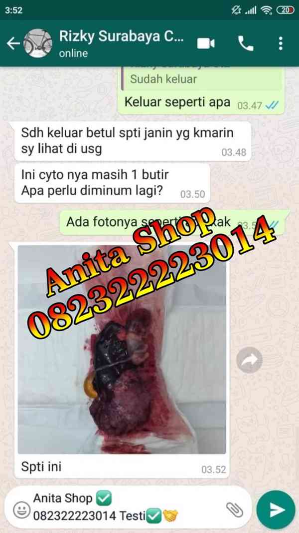 Jual Obat Cytotec Di Shopee Bekasi 082111126033 Obat Cytotec - foto 3