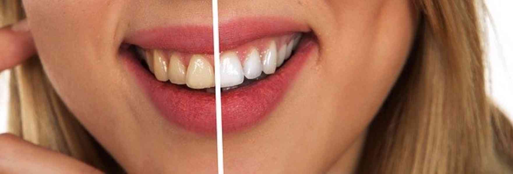 Šetrná bělící zubní pasta bez fluoru - foto 1
