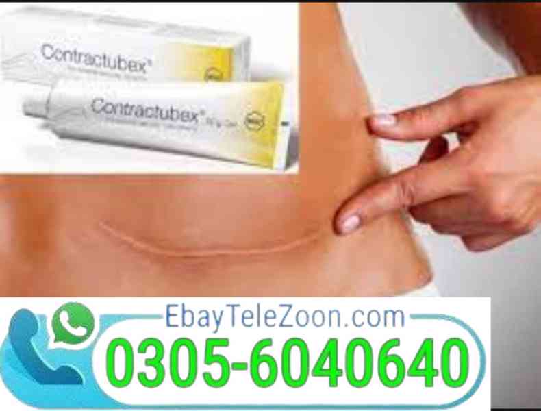 Contractubex Gel Alternative In Rawalpindi | 03000960999 - foto 1