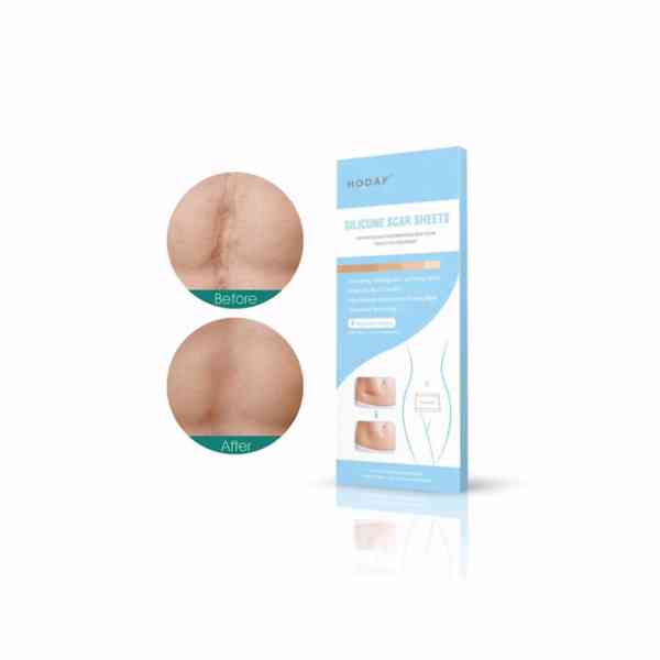 Náplast pro odstranění jizev a obnovení zářivosti pleti 4 ks - foto 6