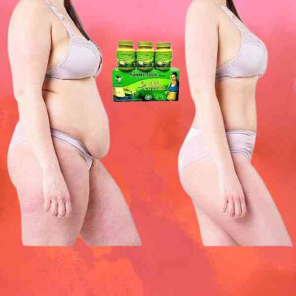 Tummy Tuck Fat Cutter Price in Gujrat<>030020^31+440?? - foto 1