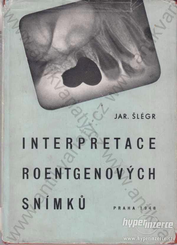 Interpretace roentgenových snímků Jar. Šlégr 1948 - foto 1
