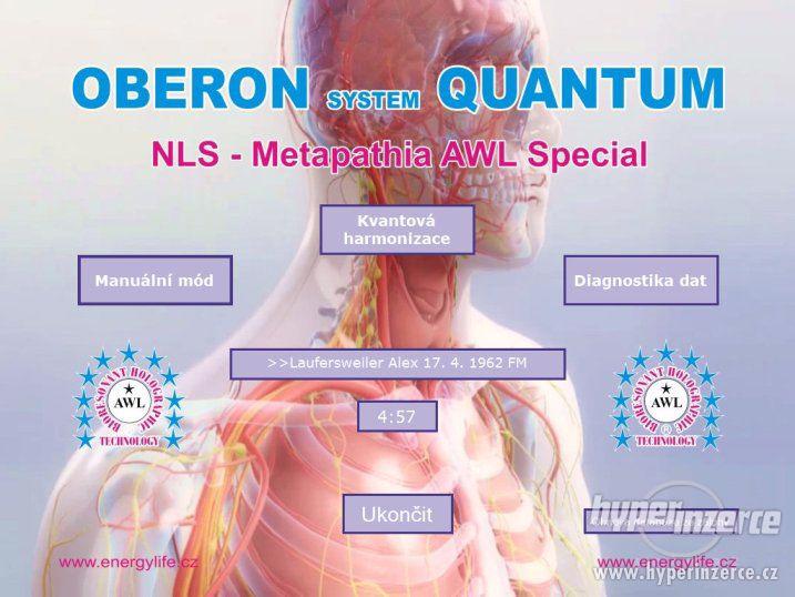 Diagnostický a harmonizační OBERON SYSTEM QUANTUM - foto 2