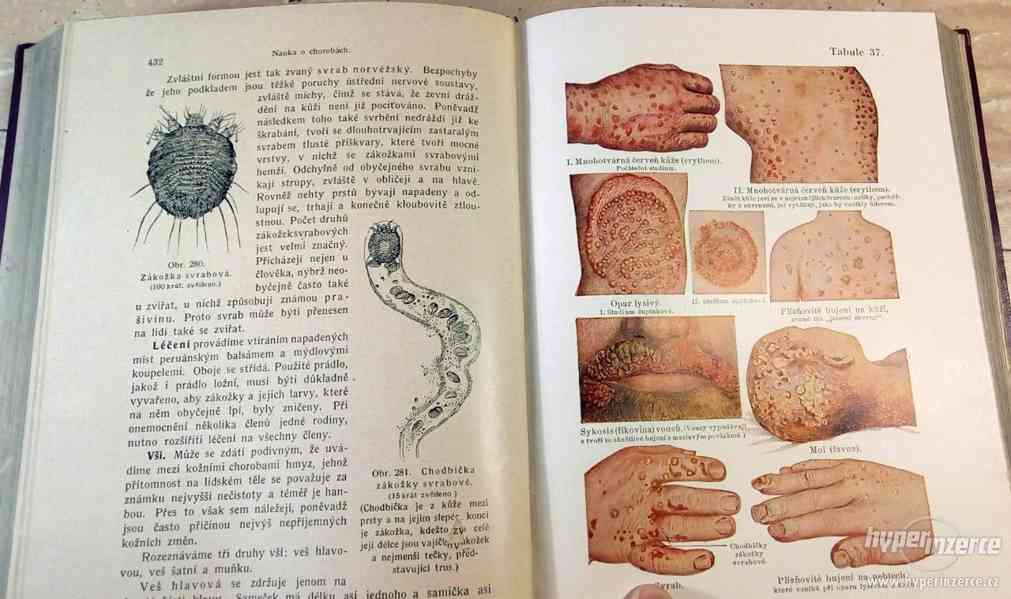 Starožitná lékařská kniha Nové domácí léčení z roku 1920 - foto 8