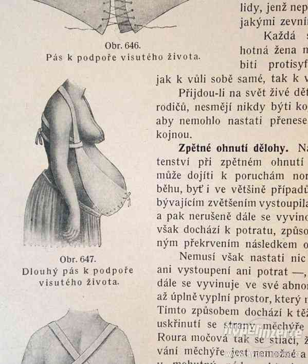 Starožitná lékařská kniha Nové domácí léčení z roku 1920 - foto 10
