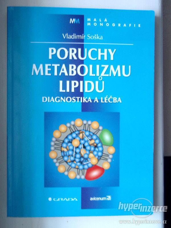 Poruchy metabolizmu lipidů – Diagnostika a léčba - foto 1