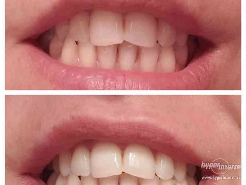 Zubní pasta Aloe Vera, 8h pocit čistých zubů - foto 2