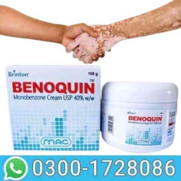 Benoquin Cream In Islamabad # 03OO1728O86 # Buy Now
