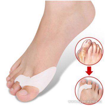 Silikonový korektor a chránič Hallux Valgus 2ks