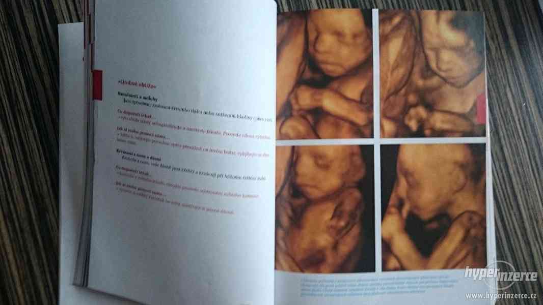 Kniha o těhotenství a dítěti - foto 5