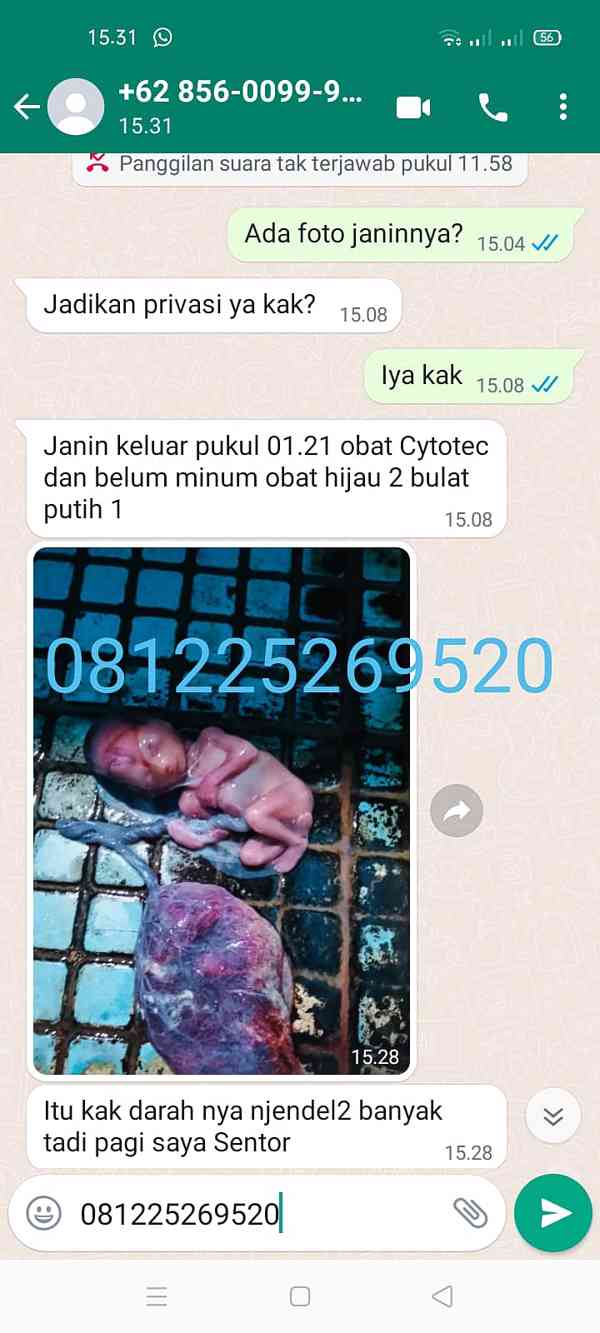 Jual Obat Aborsi Malaysia wa:081225269520 Obat Penggugur - foto 2