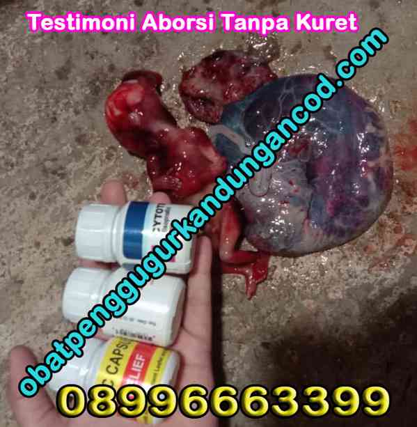 Jual Obat Aborsi Di Cipanas 0899-666-3399 Cytotec 400Mg - foto 3