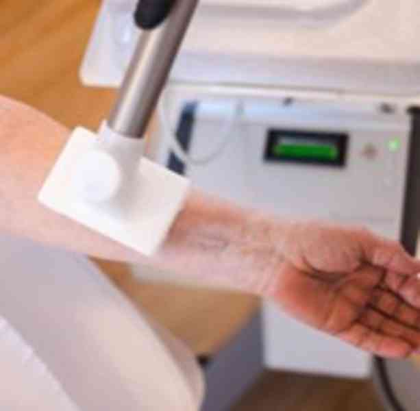 Trápí Vás nehojící se rány? Studené plasma může pomoci - foto 13