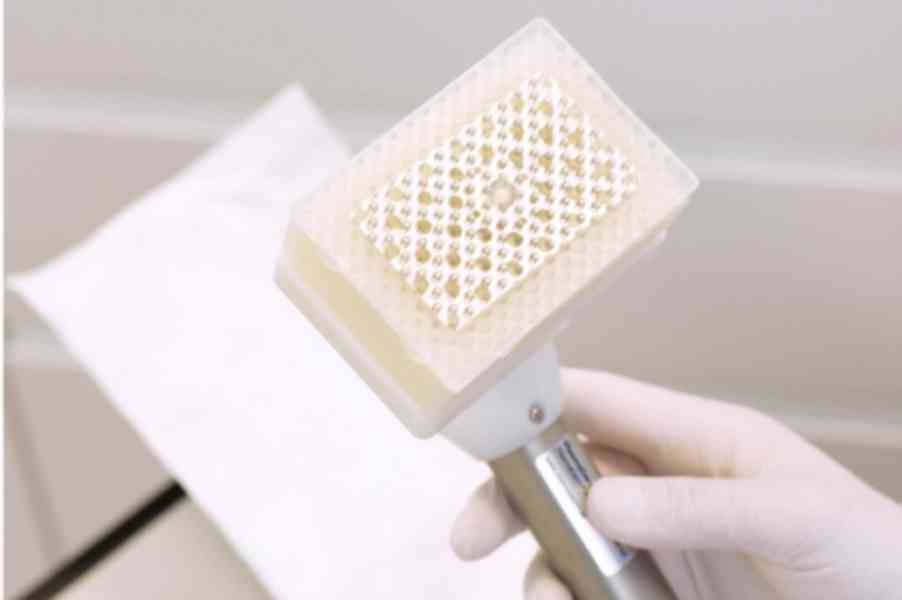 Trápí Vás nehojící se rány? Studené plasma může pomoci - foto 10