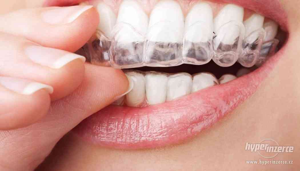 Domácí bělení zubů Opalescence 20% a 35% - foto 2