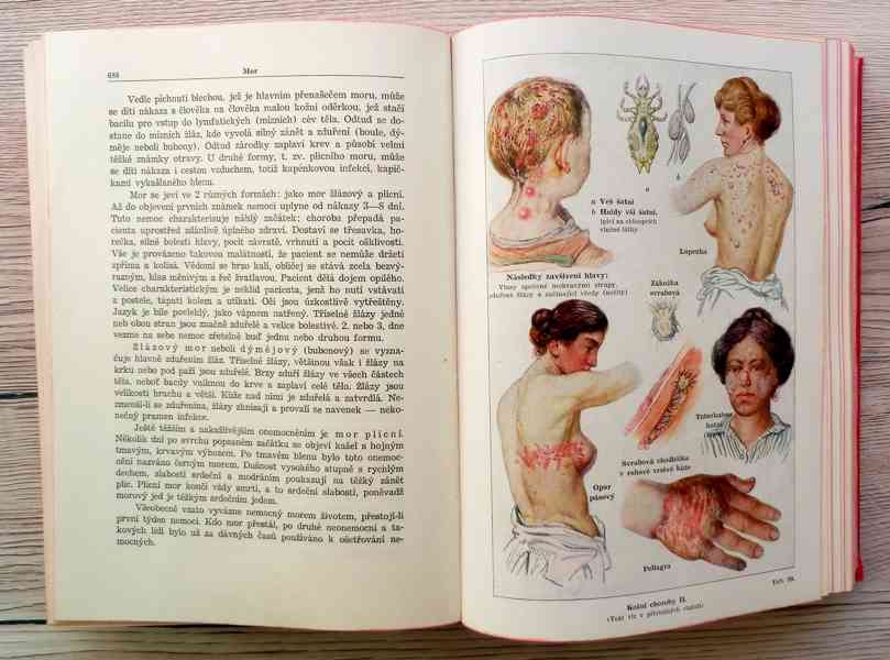 Nový lékařský rádce, starožitná lékařská kniha - foto 12