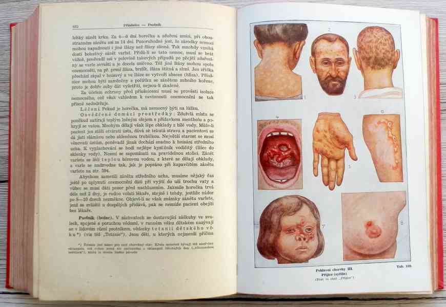 Nový lékařský rádce, starožitná lékařská kniha - foto 13