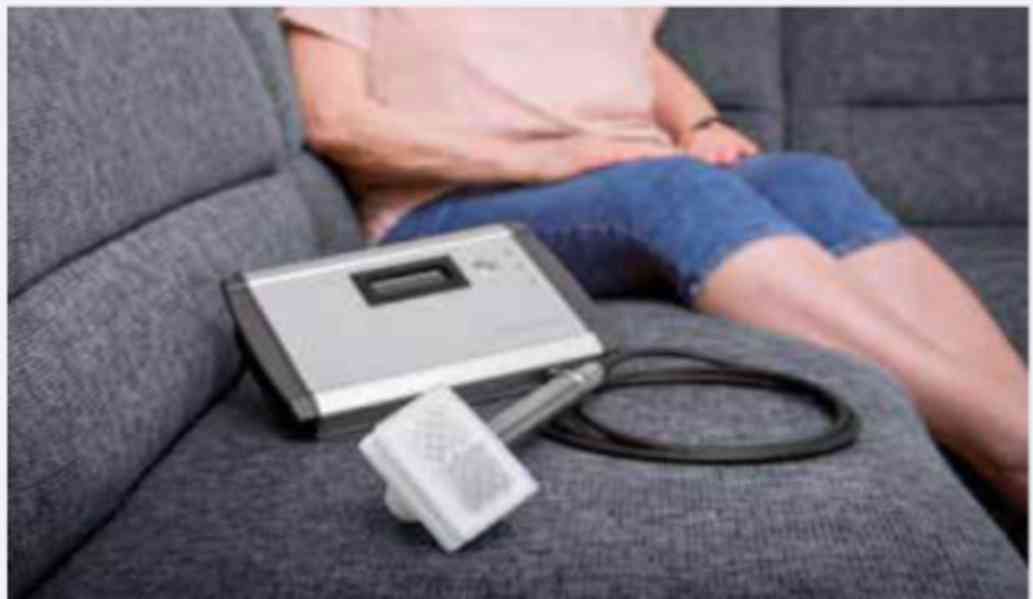 Nehojící se velké a těžké popáleniny - foto 14